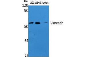 Western Blot (WB) analysis of specific cells using Vimentin Polyclonal Antibody. (Vimentin 抗体  (Tyr321))