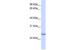 Western Blotting (WB) image for anti-Chromosome 12 Open Reading Frame 49 (C12orf49) antibody (ABIN2459339) (C12orf49 抗体)