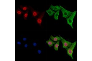 ABIN6261830 and ABIN6278360 staining Hela cells by IF/ICC. (TLS/FUS (C-Term) 抗体)