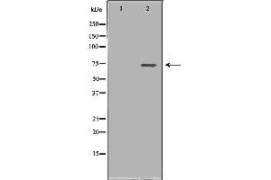 Western blot analysis of Hela whole cell lysates, using SDHA Antibody. (SDHA 抗体  (Internal Region))