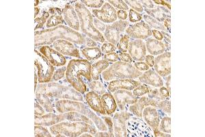 Immunohistochemistry (IHC) image for anti-Acyl-CoA Synthetase Long-Chain Family Member 4 (ACSL4) (AA 1-280) antibody (ABIN6136458)