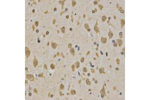 Immunohistochemistry of paraffin-embedded rat brain using Trimethyl-Histone H3-K4 antibody (ABIN5969804) at dilution of 1/200 (40x lens). (Histone 3 抗体  (H3K4me3))