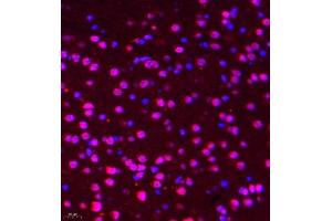 Immunofluorescence of paraffin embedded mouse brain using DGKI (ABIN7073721) at dilution of 1:650 (400x lens) (DGKI 抗体)