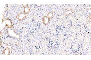 Detection of LBP in Human Kidney Tissue using Monoclonal Antibody to Lipopolysaccharide Binding Protein (LBP) (LBP 抗体  (AA 27-481))