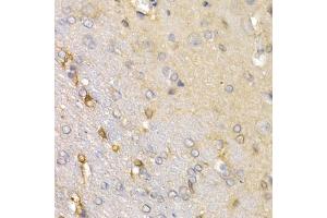 Immunohistochemistry of paraffin-embedded rat brain using SFRP2 antibody (ABIN5973117) at dilution of 1/200 (40x lens). (SFRP2 抗体)