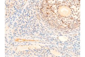 ABIN6267235 at 1/100 staining rat ovarian tissue sections by IHC-P. (PDPK1 抗体  (pSer241))
