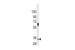 Western Blotting (WB) image for anti-Proto-Oncogene Pim-2 (Serine Threonine Kinase) (PIM2) (AA 277-308), (C-Term) antibody (ABIN392442)