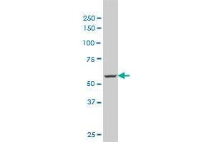 MTA1 monoclonal antibody (M02), clone 4D11. (MTA1 抗体  (AA 601-700))