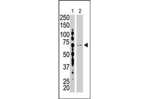 The USP2 polyclonal antibody  is used in Western blot to detect USP2 in HL-60 (lane 1) and USP2-transfected HeLa cell lysates (lane 2) . (USP2 抗体  (C-Term))