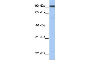 WB Suggested Anti-MMEL1 Antibody Titration:  0. (MMEL1 抗体  (Middle Region))