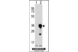 Western blot analysis of MBL2 using rabbit polyclonal MBL2 Antibody using 293 cell lysates (2 ug/lane) either nontransfected (Lane 1) or transiently transfected (Lane 2) with the MBL2 gene. (MBL2 抗体  (C-Term))