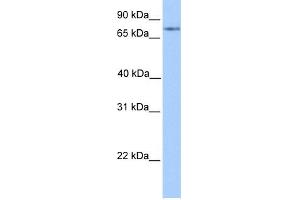 WB Suggested Anti-FOXO1 Antibody Titration:  0. (FOXO1 抗体  (C-Term))