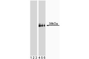Western blot analysis of LAT (pY226) in human T lymphocytes. (LAT 抗体  (pTyr226))