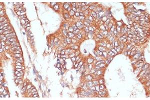 Immunohistochemistry (Paraffin-embedded Sections) (IHC (p)) image for anti-Protein tyrosine Phosphatase, Receptor Type, N Polypeptide 2 (PTPRN2) antibody (ABIN7258118)