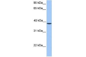 SUNC1 antibody used at 1 ug/ml to detect target protein. (SUN3 抗体  (C-Term))