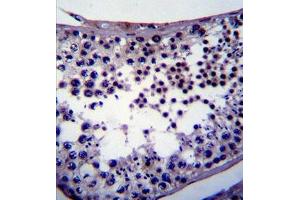 Immunohistochemistry (IHC) image for anti-Nanog Homeobox (NANOG) antibody (ABIN356386)