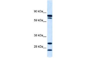 WB Suggested Anti-ZNF606 Antibody Titration:  0. (ZNF606 抗体  (N-Term))