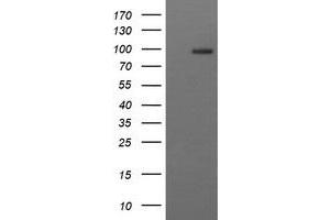 Image no. 2 for anti-CD22 Molecule (CD22) antibody (ABIN1497211) (CD22 抗体)