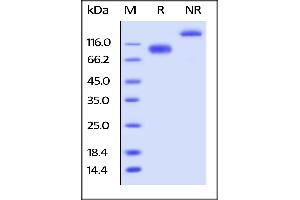 Human LILRB3, Fc Tag on  under reducing (R) and ing (NR) conditions.