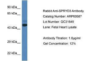 Western Blotting (WB) image for anti-SPRY Domain Containing 3 (SPRYD3) (N-Term) antibody (ABIN2788536) (SPRYD3 抗体  (N-Term))