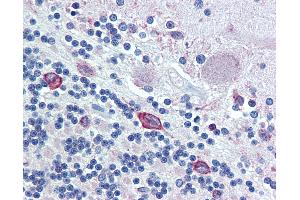 Anti-ERp72 antibody IHC of human brain, cerebellum. (PDIA4 抗体  (AA 623-638))