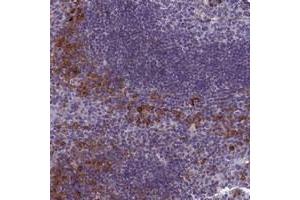 Immunohistochemical staining of human tonsil with CNEP1R1 polyclonal antibody  shows strong cytoplasmic positivity in subsets of cells outside germinal center at 1:20-1:50 dilution. (CTD Nuclear Envelope Phosphatase 1 Regulatory Subunit 1 (CNEP1R1) 抗体)