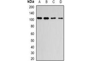 Western blot analysis of DPP8 expression in MCF7 (A), Hela (B), mouse brain (C), rat lung (D) whole cell lysates. (DPP8 抗体)