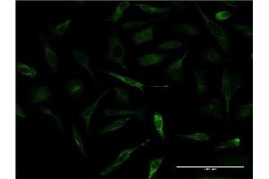 Immunofluorescence of monoclonal antibody to APOA2 on HeLa cell. (APOA2 抗体  (AA 1-100))