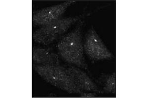 Immunofluorescence staining of Autophagy UVRAG Antibody  on Methanol-fixed HeLa cells. (UVRAG 抗体  (C-Term))