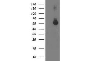 HEK293T cells were transfected with the pCMV6-ENTRY control (Left lane) or pCMV6-ENTRY ITFG2 (Right lane) cDNA for 48 hrs and lysed. (ITFG2 抗体)