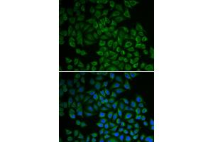 Immunofluorescence analysis of HeLa cells using SGK1 antibody (ABIN5970402). (SGK1 抗体)