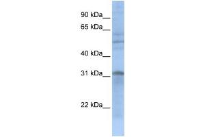 WB Suggested Anti-MTCH2  Antibody Titration: 0. (MTCH2 抗体  (N-Term))