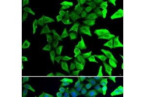 Immunofluorescence analysis of U2OS cells using VSNL1 Polyclonal Antibody (VSNL1 抗体)