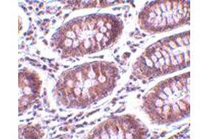 Immunohistochemistry of MICA in human colon tissue with MICA polyclonal antibody  at 10 ug/mL . (MICA 抗体  (C-Term))
