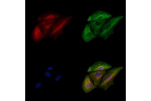 ABIN6261955 and ABIN6278574 staining  cells by IF/ICC.