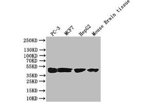 Western Blot Positive WB detected in: PC-3 whole cell lysate, Mouse liver tissue All lanes: DGAT2 antibody at 3 μg/mL Secondary Goat polyclonal to rabbit IgG at 1/50000 dilution Predicted band size: 44, 40 kDa Observed band size: 44 kDa (DGAT2 抗体  (AA 1-66))