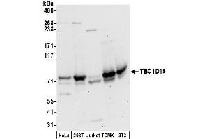 anti-TBC1 Domain Family, Member 15 (TBC1D15) (AA 1-50) antibody