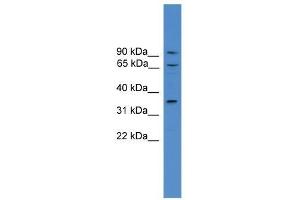 Western Blot showing CCIN antibody used at a concentration of 1-2 ug/ml to detect its target protein.