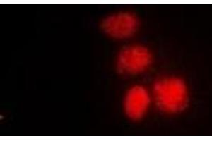 Immunofluorescent analysis of XPV staining in HepG2 cells. (POLH 抗体)