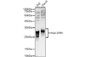 Western blot analysis of extracts of various cell lines, using HLA-DPB1 antibody (ABIN7268370) at 1:1000 dilution. (HLA-DPB1 抗体)