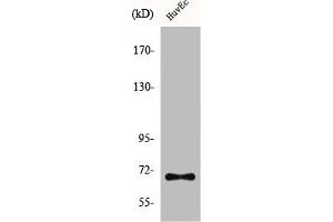 Western Blot analysis of HuvEc cells using CTPS Polyclonal Antibody (CTP Synthase 抗体  (N-Term))