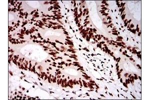 anti-Cell Cycle and Apoptosis Regulator 2 (CCAR2) antibody
