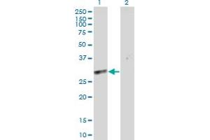 Western Blot analysis of SLC25A5 expression in transfected 293T cell line by SLC25A5 MaxPab polyclonal antibody. (SLC25A5 抗体  (AA 1-298))