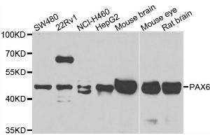 Western blot analysis of extracts of various cell lines, using PAX6 antibody. (PAX6 抗体  (AA 1-300))