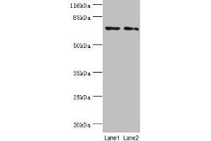 Western blot All lanes: MAGEC3 antibody at 2 μg/mL Lane 1: A375 whole cell lysate Lane 2: Rat thymus tissue Secondary Goat polyclonal to rabbit IgG at 1/10000 dilution Predicted band size: 72, 39 kDa Observed band size: 72 kDa (MAGEC3 抗体  (AA 75-197))