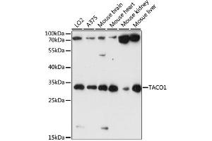 Western blot analysis of extracts of various cell lines, using TACO1 antibody (ABIN6292793) at 1:1000 dilution. (TACO1 抗体)
