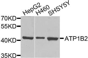 Western blot analysis of extracts of various cells, using ATP1B2 antibody. (ATP1B2 抗体)