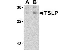 Western blot analysis of TSLP in Jurkat cell lysate with this product at (A) 1 and (B) 2 μg/ml. (Thymic Stromal Lymphopoietin 抗体  (C-Term))