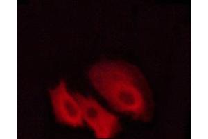 ABIN6267408 staining Hela cells by ICC/IF. (PKC 抗体  (pThr497))