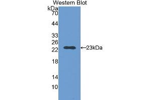 Western Blotting (WB) image for anti-Slow Skeletal Troponin I (TNNI1) (AA 1-187) antibody (ABIN1176057) (TNNI1 抗体  (AA 1-187))